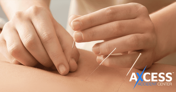 Acupuncture Available in Utah
